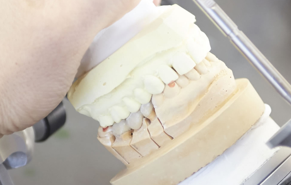 入れ歯の調整・入れ歯の製作